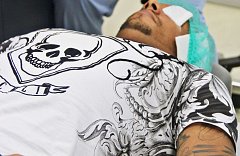 Augenlaseroperation deutsche Augenklinik iClinic Fussballspieler 01