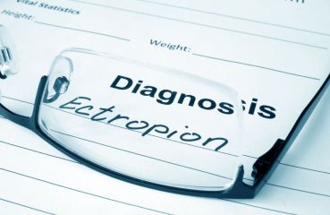 Ektropium – alles Wichtige über Ursachen, Symptome und Therapiemöglichkeiten