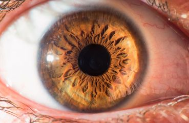 Netzhautablösung – Symptome, Ursachen, Risikofaktoren, Diagnose und Behandlung