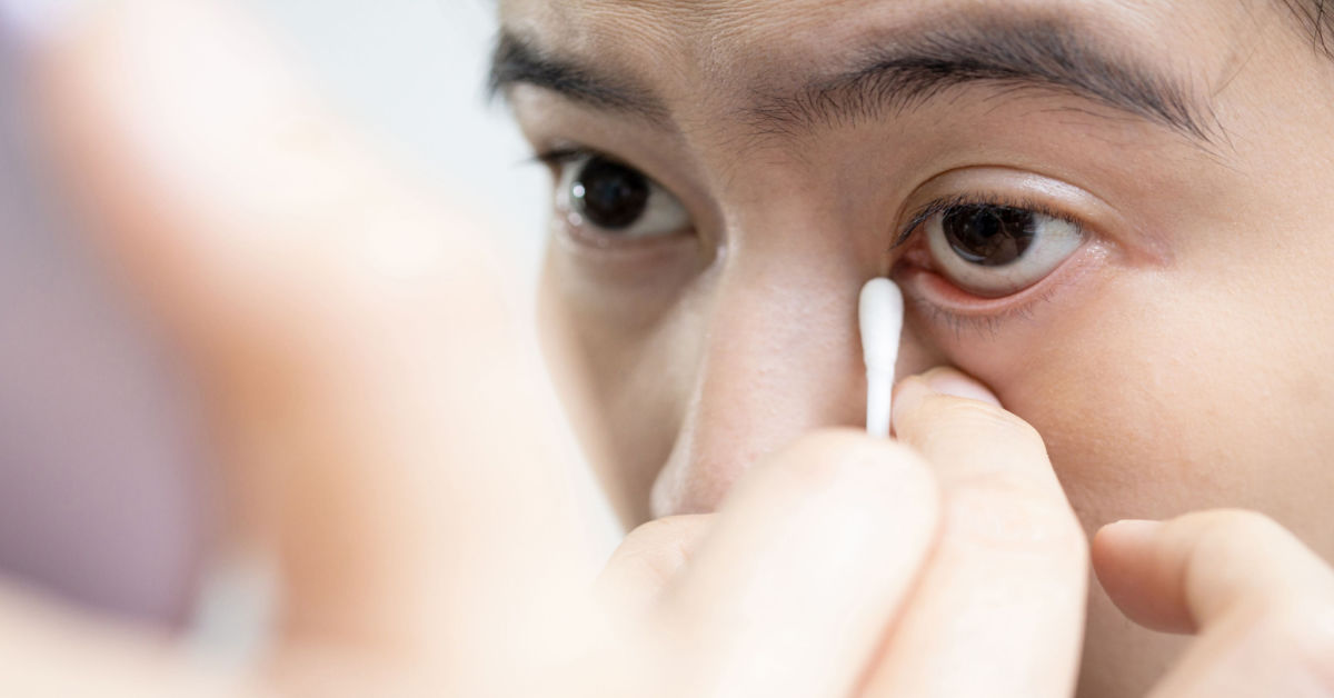 Ektropium – alles Wichtige über Ursachen, Symptome und Therapiemöglichkeiten Ektropium – alles Wichtige über Ursachen, Symptome und Therapiemöglichkeiten