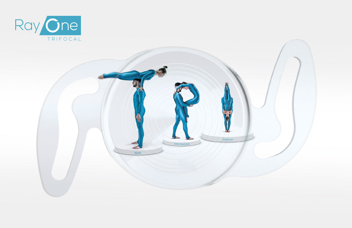 Ausschliesslich Präzisionslinsen kommen bei der iClinic zum Einsatz Ausschliesslich Präzisionslinsen kommen bei der iClinic zum Einsatz